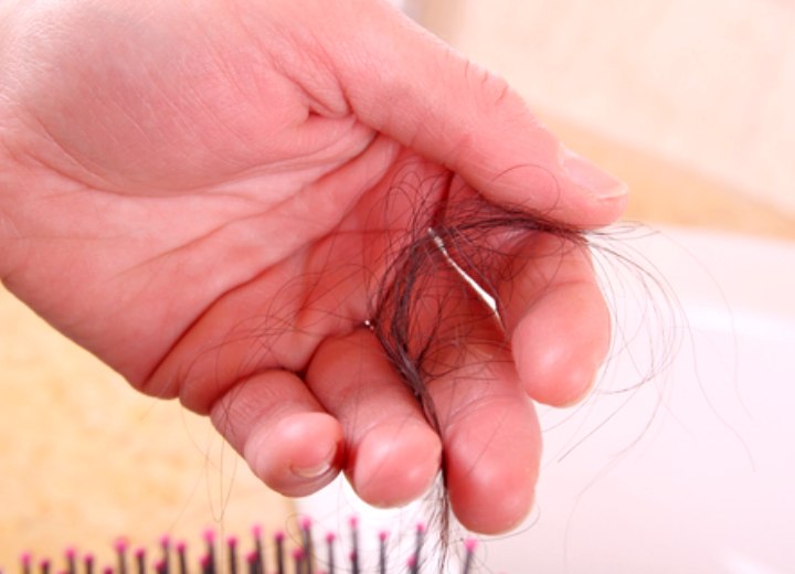 Perte de cheveux