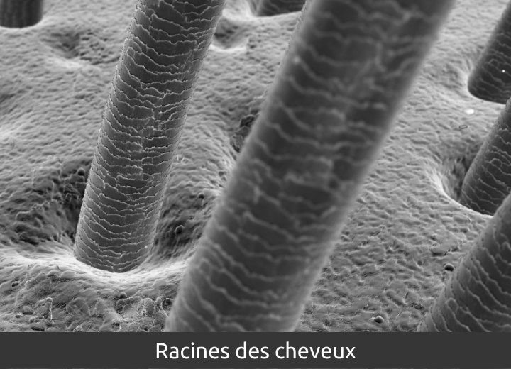 Racines des cheveux telles qu'observées sous un microscope