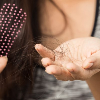 La perte de cheveux chez les femmes